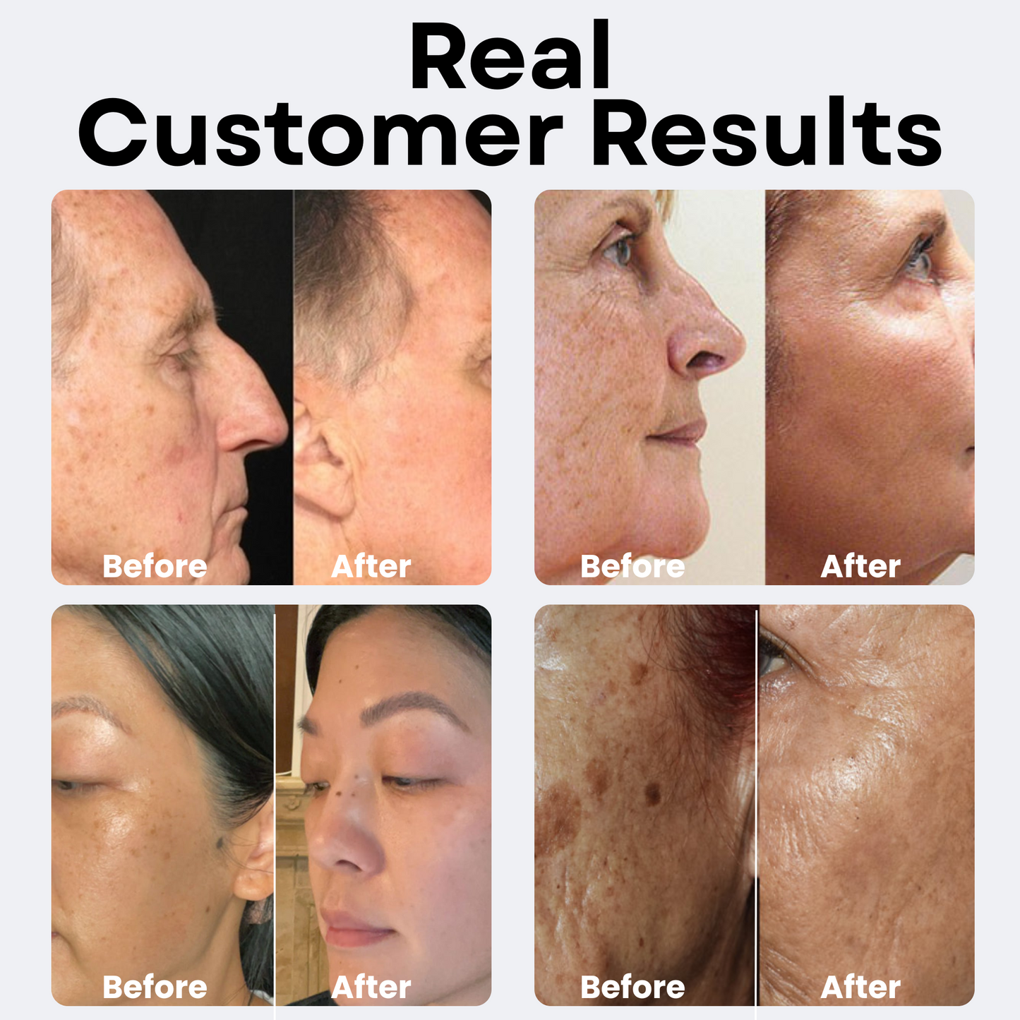 Dark Spot Serum for Older Skin